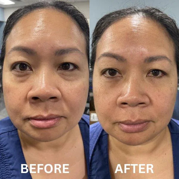 Collagen Infusion Eye Patches